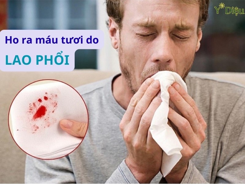 Ho ra máu là hiện tượng xuất hiện máu khi ho.